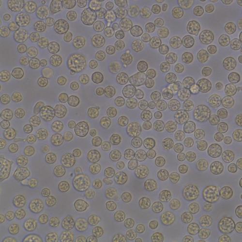 Naegleria fowleri